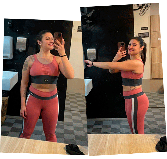 Depois - foto de frente